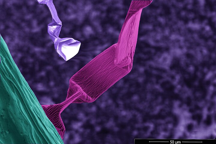 Obraz z mikroskopii elektronowej